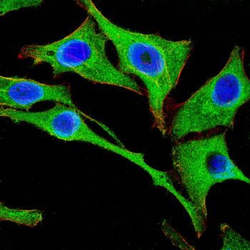 PPP1CB Antibody