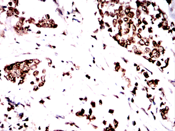 PPP1CB Antibody