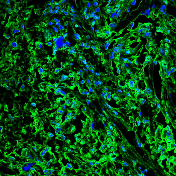 PPP1CB Antibody
