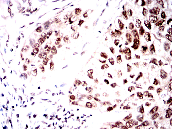 PPP1CB Antibody