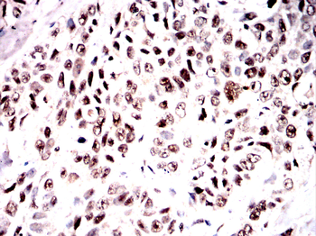 PPP1CB Antibody