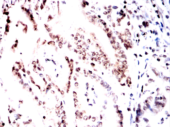 PPP1CB Antibody