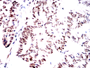 PPP1CB Antibody