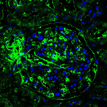 PRKCG Antibody