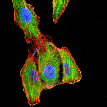 TUBE1 Antibody