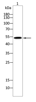 TUBE1 Antibody