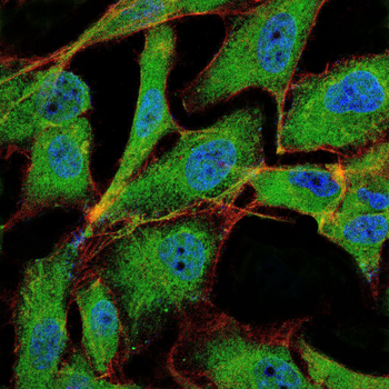 TUBE1 Antibody