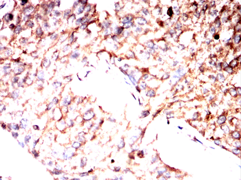 TUBE1 Antibody