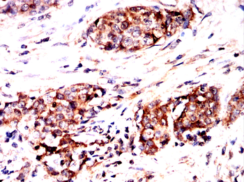 TUBE1 Antibody