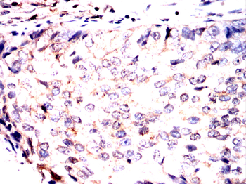 TUBE1 Antibody