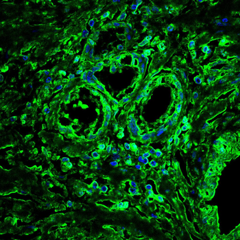 TUBE1 Antibody