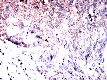 TUBE1 Antibody