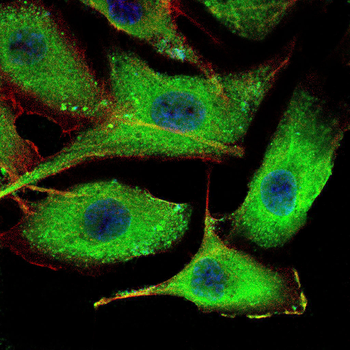 RANBP9 Antibody
