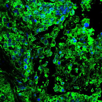 RANBP9 Antibody