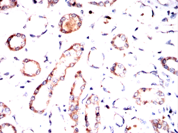 RANBP9 Antibody
