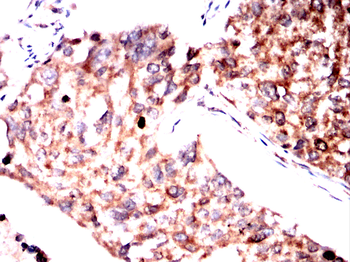 PIK3CG Antibody