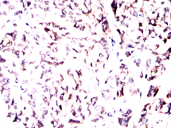 APP Antibody