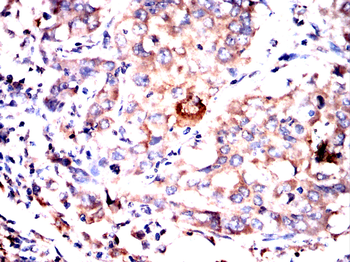 APP Antibody