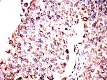 WAS Antibody