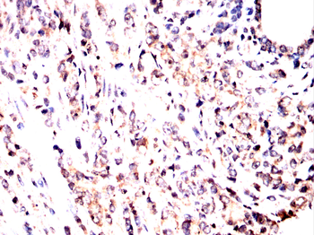 WAS Antibody