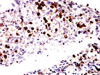 WAS Antibody