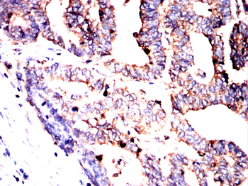 WAS Antibody