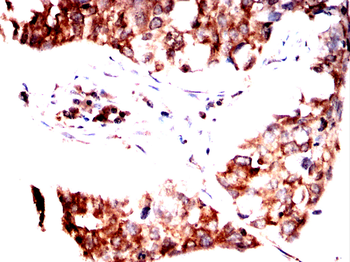 WAS Antibody