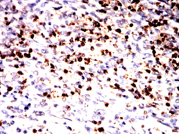 WAS Antibody