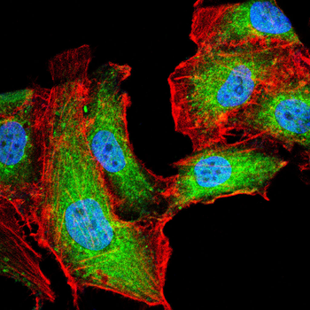 CSNK2B Antibody