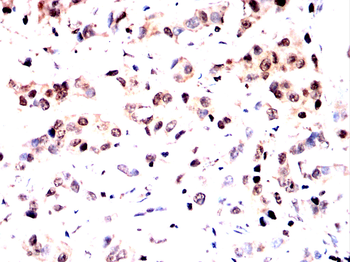 CSNK2B Antibody