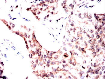 CSNK2B Antibody