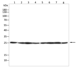 CSNK2B Antibody