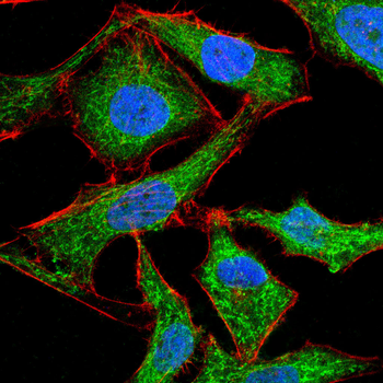 CSNK2B Antibody