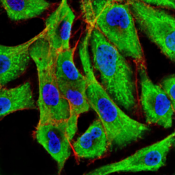 PTPN1 Antibody