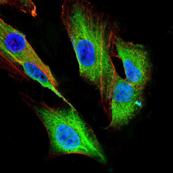 SEMA3A Antibody