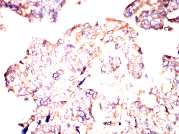 SEMA3A Antibody