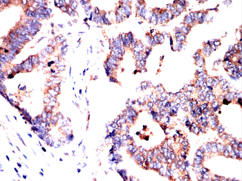 SEMA3A Antibody