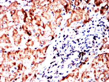 SEMA3A Antibody