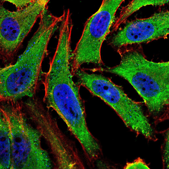 SEMA3A Antibody