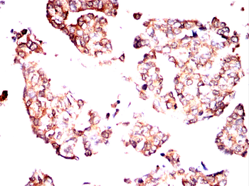 SEMA3A Antibody