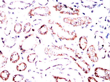SEMA3A Antibody