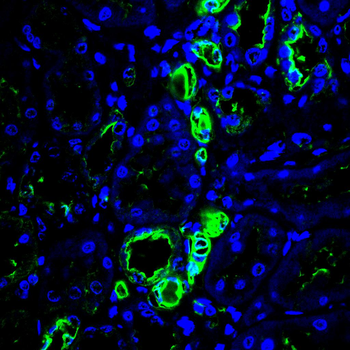 SEMA3A Antibody
