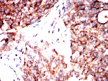 SEMA3A Antibody