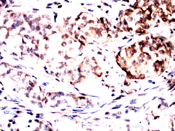 PLCG2 Antibody