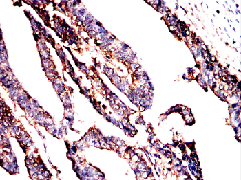 PLCG2 Antibody