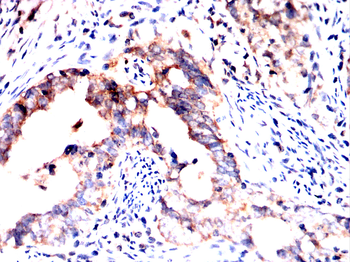 PLCG2 Antibody