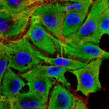 TRIM63 Antibody