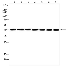 TRIM63 Antibody