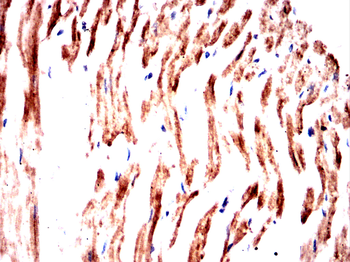 TRIM63 Antibody