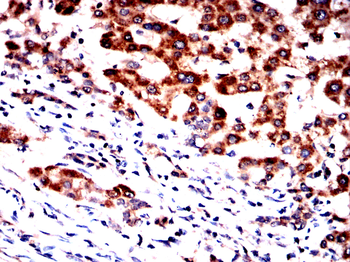 TRIM63 Antibody